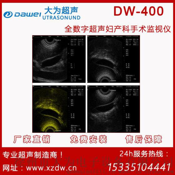 可视人流机价格/可视人流生产厂家 DW-400