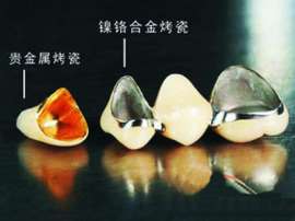 深圳合金烤瓷牙 金属烤瓷牙钛合金烤瓷牙
