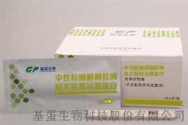 中性粒细胞明胶酶相关脂质运载蛋白检测试剂盒