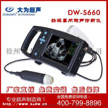 低价促销DW-S660 掌上便携式B超机 兽用b超机