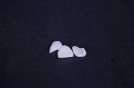 义获嘉超薄贴面 深圳全瓷 正品直销